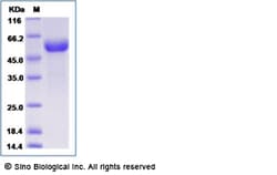 Sino Biological Mouse CD8a / Lyt2 (Fc Tag) 50ug, Quantity: Each of 1