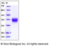Sino Biological Recombinant Mouse CD8 alpha Protein (His Tag), HPLC-verified,