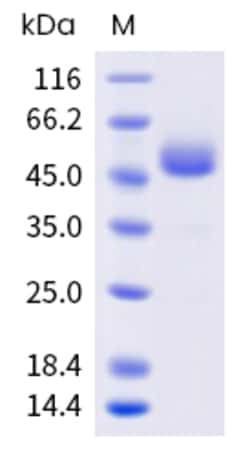 Sino Biological Mouse CD7 Protein 1MG (Sino Biological), Quantity: Each