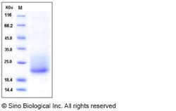 Sino Biological Recombinant Mouse CD7 Protein (His Tag), Quantity: Each