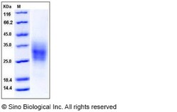 Sino Biological Recombinant Mouse DR5/TRAIL R2 Protein (His Tag), Quantity: