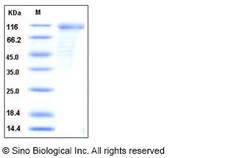 Sino Biological Mouse CD36 / SCARB3 Protein (His & Fc Tag) 100ug, Quantity: