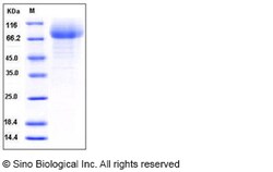 Sino Biological Recombinant Mouse CD36 Protein (His Tag), HPLC-verified,