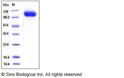 Sino Biological Mouse ICAM-1 / CD54 Protein (His Tag) 50ug, Quantity: Each