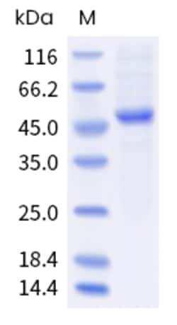 Sino Biological Mouse LEP Protein 1MG (Sino Biological), Quantity: Each
