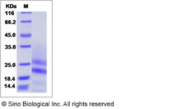 Sino Biological Recombinant Mouse PDGF-A Protein (His Tag), Quantity: Each