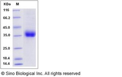 Sino Biological Recombinant Mouse Prolactin Receptor Protein (His Tag),