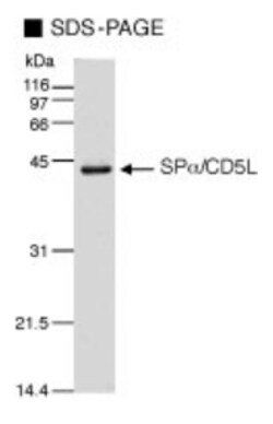 MBL International Corporation CircuLex Human AIM/CD5L/Spalpha, Quantity: