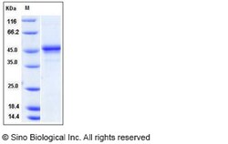 Sino Biological Recombinant Mouse PDGF-C Protein (hFc Tag), Quantity: Each