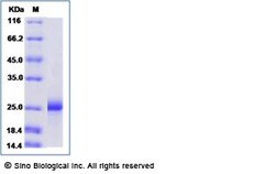 Sino Biological Recombinant Mouse PDGF-C Protein (His Tag), Quantity: Each