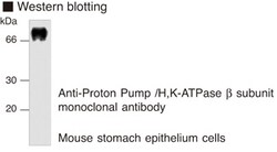 MBL International Corporation Anti-Proton Pump (H, K-ATPasebeta subunit)