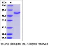 Sino Biological Recombinant Mouse SPOCK3 Protein (His Tag), Quantity: Each