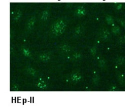 MBL International Corporation Anti-CENP-A (Human) mAb (Monoclonal Antibody),
