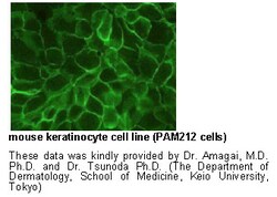 MBL International Corporation Anti-Desmoglein 3 (Mouse) mAb (No Azide)