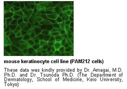 MBL International Corporation Anti-Desmoglein 3 (Mouse) mAb (No Azide)