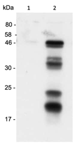 AdipoGen anti-Caspase-1 (p20) (human), mAb (Bally-1),Monocl, Quantity: