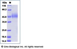 Sino Biological Recombinant Mouse ICOS Protein (rFc Tag), Quantity: Each