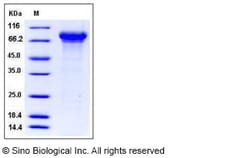 Sino Biological Recombinant Mouse Kininogen 1 Protein (His Tag), Quantity: