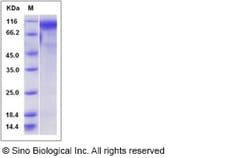 Sino Biological Recombinant Mouse Osteoactivin/GPNMB Protein (His Tag)