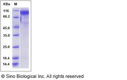 Sino Biological Recombinant Mouse Osteoactivin/GPNMB Protein (His Tag),