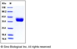 Sino Biological Recombinant Mouse CADM3 Protein (His Tag), Quantity: Each