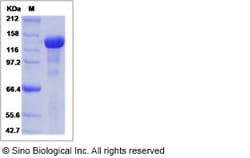 Sino Biological Recombinant Mouse EGF Protein (His Tag), Quantity: Each