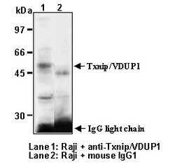 MBL International Corporation Anti-Txnip (VDUP1) (Human) mAb (Monoclonal
