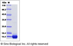 Sino Biological Recombinant Mouse S100A4 Protein (His Tag), Quantity: Each