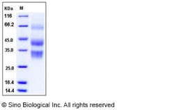 Sino Biological Recombinant Mouse Clusterin Protein (His Tag), Quantity: