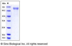 Sino Biological Recombinant Mouse RP105/CD180 Protein (His Tag), HPLC-verified,