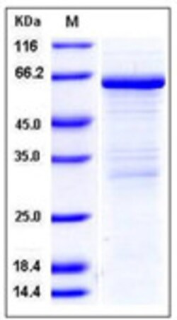 Sino Biological Recombinant Mouse MMP-8 Protein, Quantity: Each of 1