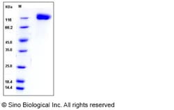 Sino Biological&nbsp;Recombinant Mouse OSMR Protein (His Tag), HPLC-verified 1