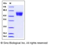 Sino Biological Recombinant Mouse CADM4 Protein (His Tag), Quantity: Each