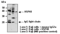 MBL International Corporation Anti-Hsp40 (Human) mAb (Monoclonal Antibody),
