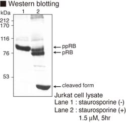 MBL International Corporation Anti-Rb (Human) mAb (Monoclonal Antibody),