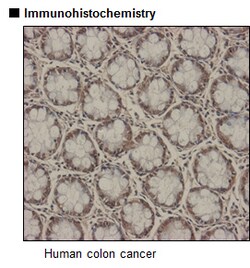 MBL International Corporation Anti-rck (p54) pAb (Polyclonal Antibody),