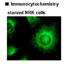 MBL International Corporation Anti-p62 (SQSTM1) (Human) pAb (Polyclonal