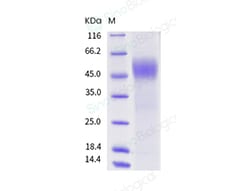 Sino Biological Recombinant Mouse CD19 Protein (ECD, His Tag), Quantity: