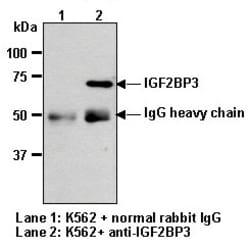 MBL International Corporation Anti-IGF2BP3 (IMP3) (Human/Mouse) pAb (Polyclonal