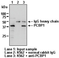 MBL International Corporation Anti-PCBP1 (Human) pAb (Polyclonal Antibody),