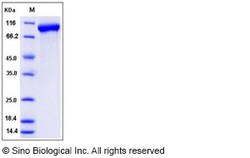 Sino Biological Recombinant Mouse LRIG1 Protein (His Tag), Quantity: Each