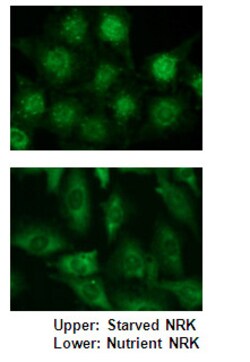 MBL International Corporation Anti-p62 C-terminal (Human) pAb (Polyclonal
