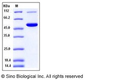 Sino Biological Recombinant Mouse carboxylesterase 2/CES2 Protein (His