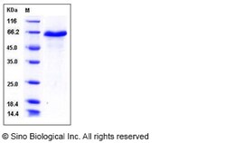 Sino Biological Recombinant Mouse DLL1 Protein (His Tag), Quantity: Each