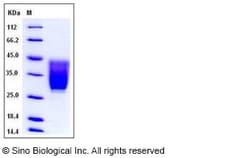 Sino Biological Recombinant Mouse CD99L2 Protein (His Tag), Quantity: Each