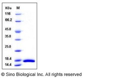 Sino Biological Recombinant Mouse CRABP2 Protein (His Tag), HPLC-verified,