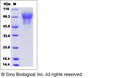Sino Biological Mouse SynCam / CADM1 / TSLC1 / IGSF4 Protein (His Tag)