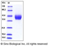 Sino Biological Mouse Adipsin / Complement Factor D / CFD Protein (His