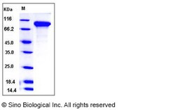 Sino Biological Mouse DDR2 Kinase / CD167b Protein (His Tag) 100ug, Quantity: