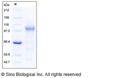 Sino Biological Recombinant Mouse TGF-beta RIII/TGFBR3 Protein (His Tag),